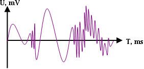 Диаграмма звукового сигнала