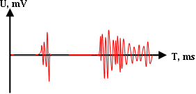 Диаграмма звукового сигнала после ФВЧ